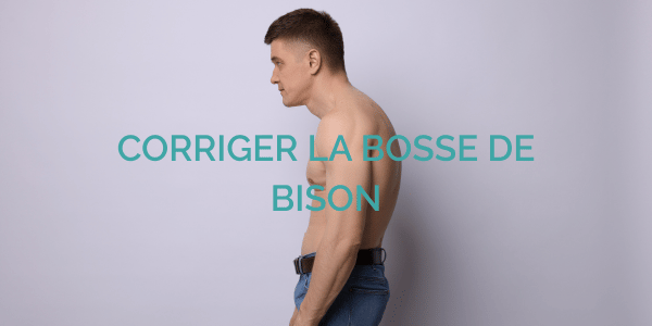 Qu’est-ce que la posture de bison et comment la corriger naturellement ?